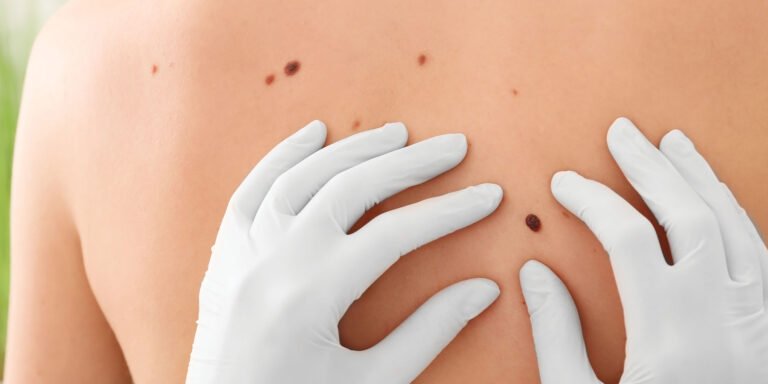 doctor looking over moles on a persons back