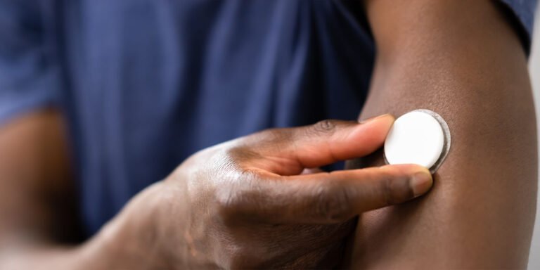 Person with a round white glucose monitor on their arm